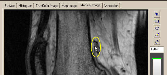 Interactions can be used to draw regions-of-interest on images.