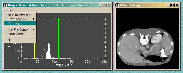We specialize in interactive image processing functionality.