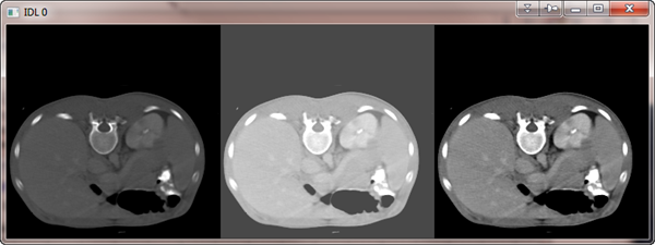 Data scaled with a standard deviation scaling.