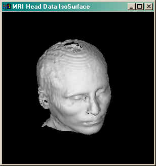 An isosurface of an MRI volume stack of images.