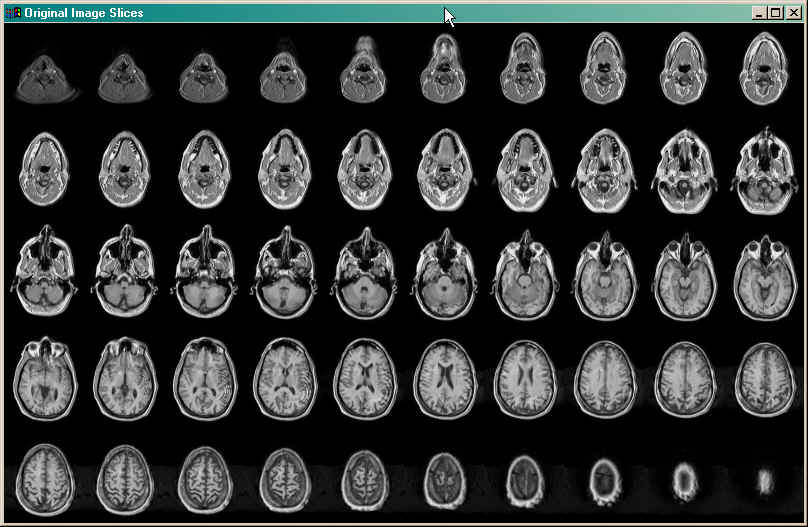 The original MRI image slices.