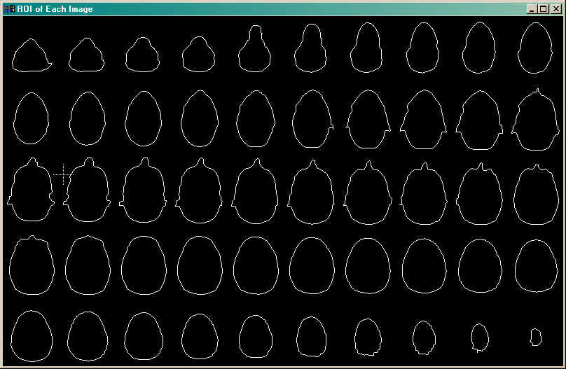 The collection of ROIs created for each image slice.