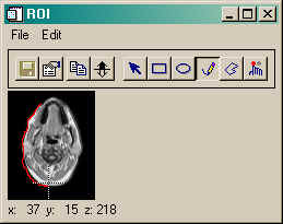 Drawing an ROI with XROI and the free-hand pencil tool.