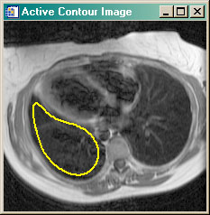 The initial contour guess.