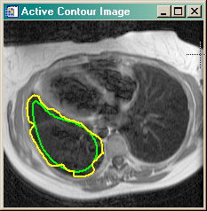 Intermediate contour steps.
