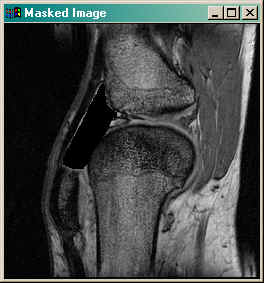 The image with the ROI masked out.