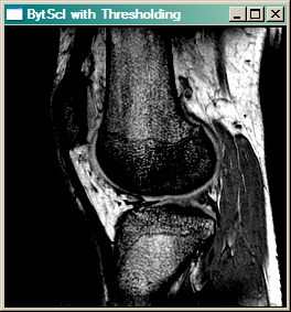 Byte scaled image with thresholding.