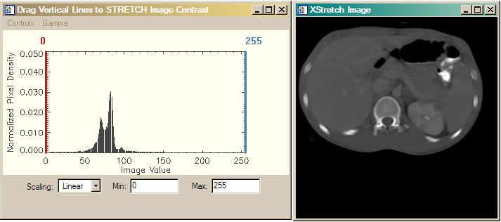 The image histogram.