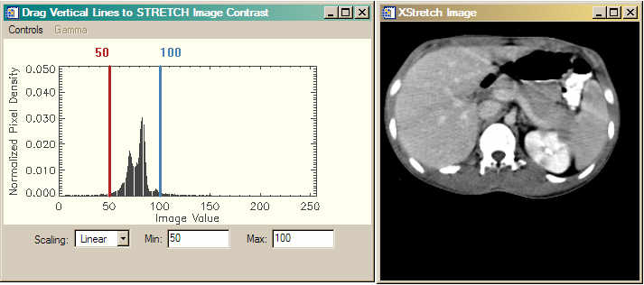 The image histogram provides logical threshold factors.