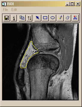 The XROI tool with a region of interest shown.